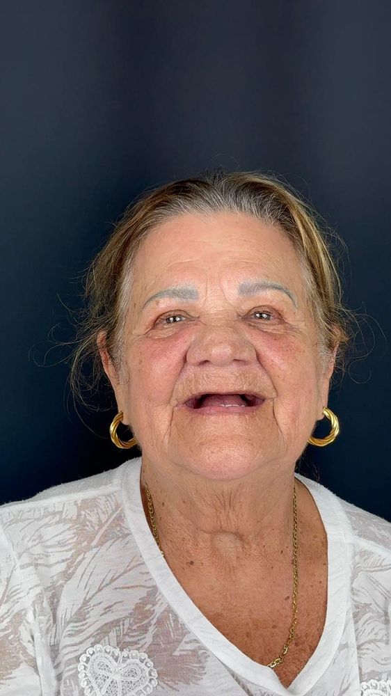 Retrato de reabilitação completa — antes